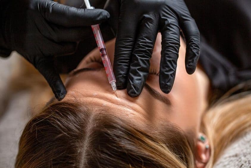 Young woman receiving filler in her forehead.