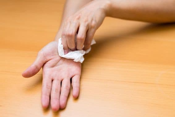 Woman suffering from sweaty hands.